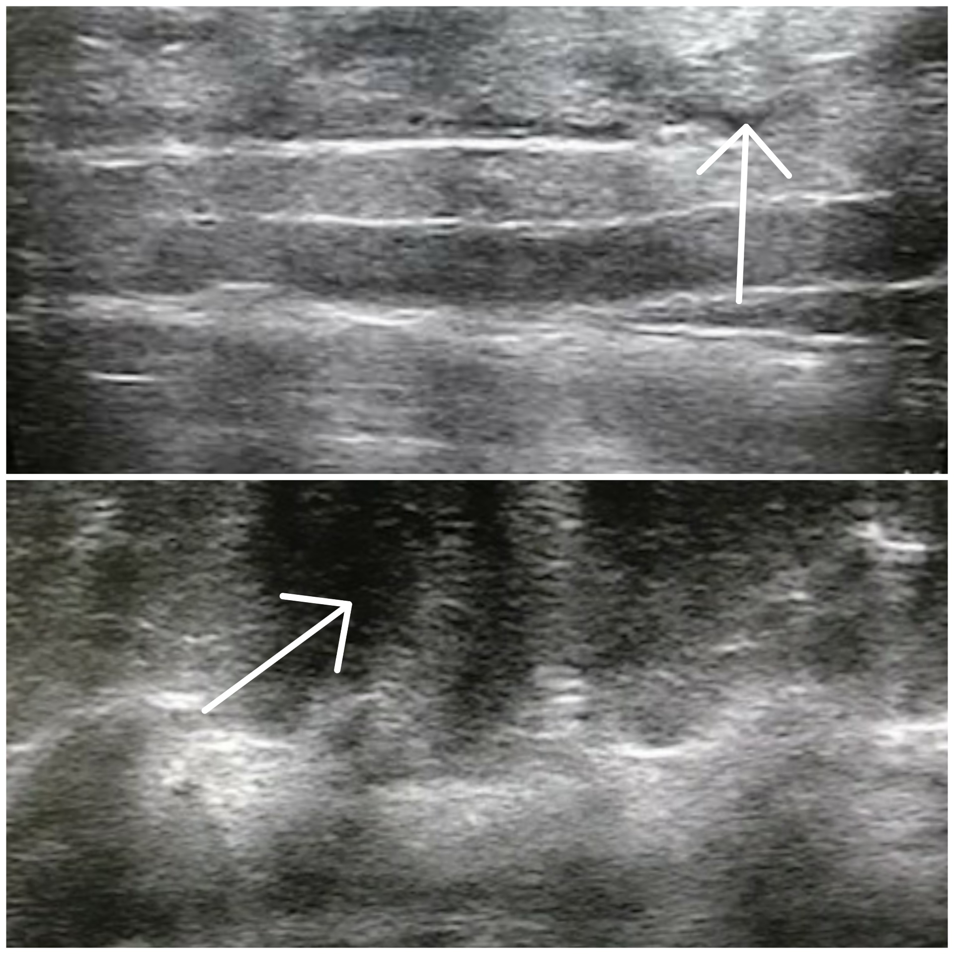 Ultraschall-Untersuchung, Grafental-Klinik Ultraschall-Untersuchung