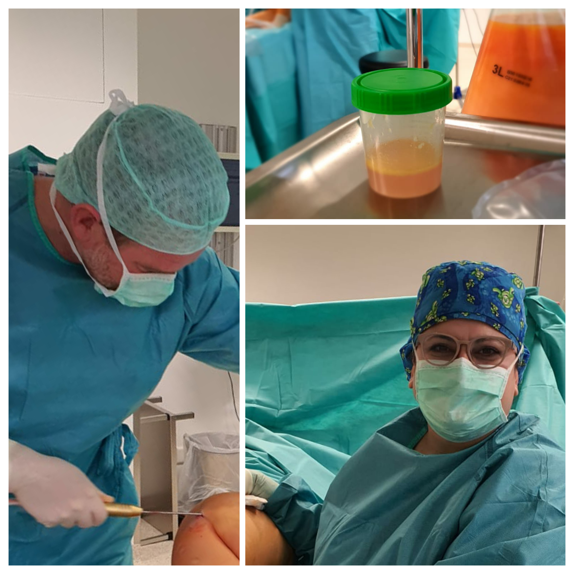 wasserstrahl-assestierte Liposuktion, Grafental-Klinik wasserstrahl-assestierte Liposuktion