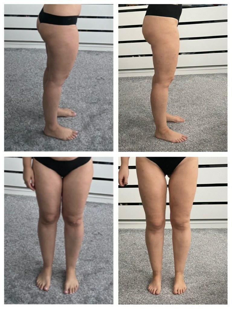 Vorher/Nachher-Bilder, Grafental-Klinik Vorher/Nachher-Bilder